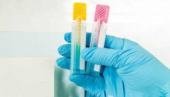 Metodat e diagnostikimit të parazitit